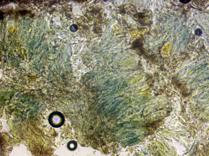 Arthonia antillarum 11 - Himenio Melzer x 400